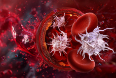 Врач назвала главные причины повышения уровня тромбоцитов