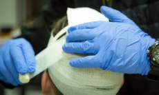 Это надо лечить. Даже легкая травма головы повышает риск опасного заболевания