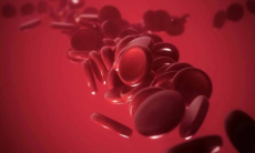 Названы необычные симптомы дефицита железа