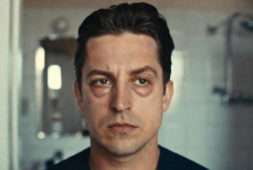 Как вернуть лицу свежесть после новогодних праздников — советы врача-косметолога