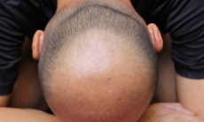 Какой фактор снижает тестостерон быстрее, чем старение