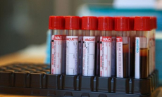 Что делать при повышенном гемоглобине?