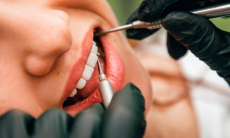 Как часто надо менять зубные имплантаты